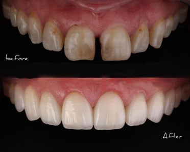 General Dentist Melbourne CBD, Top leading Cosmetic Dentist in Melbourne CBD