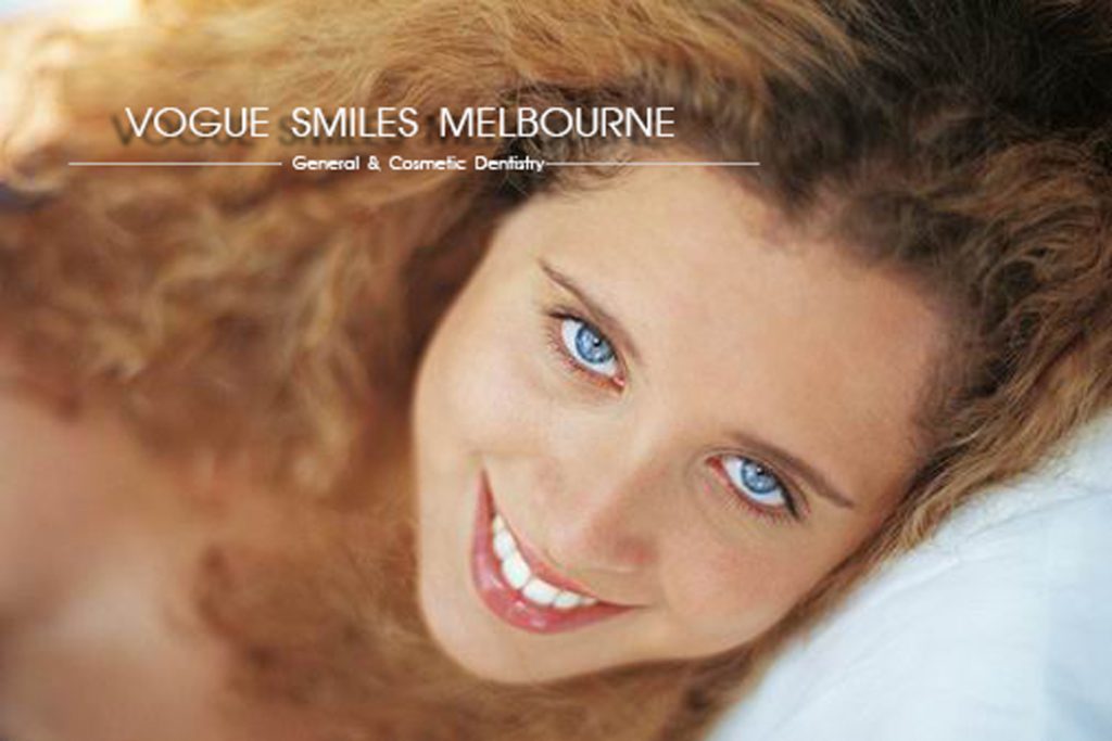 instant veneers - dental bonding -composite Veneers -Vogue Smiles Melbourne -Cosmetic Dentist Melbourne