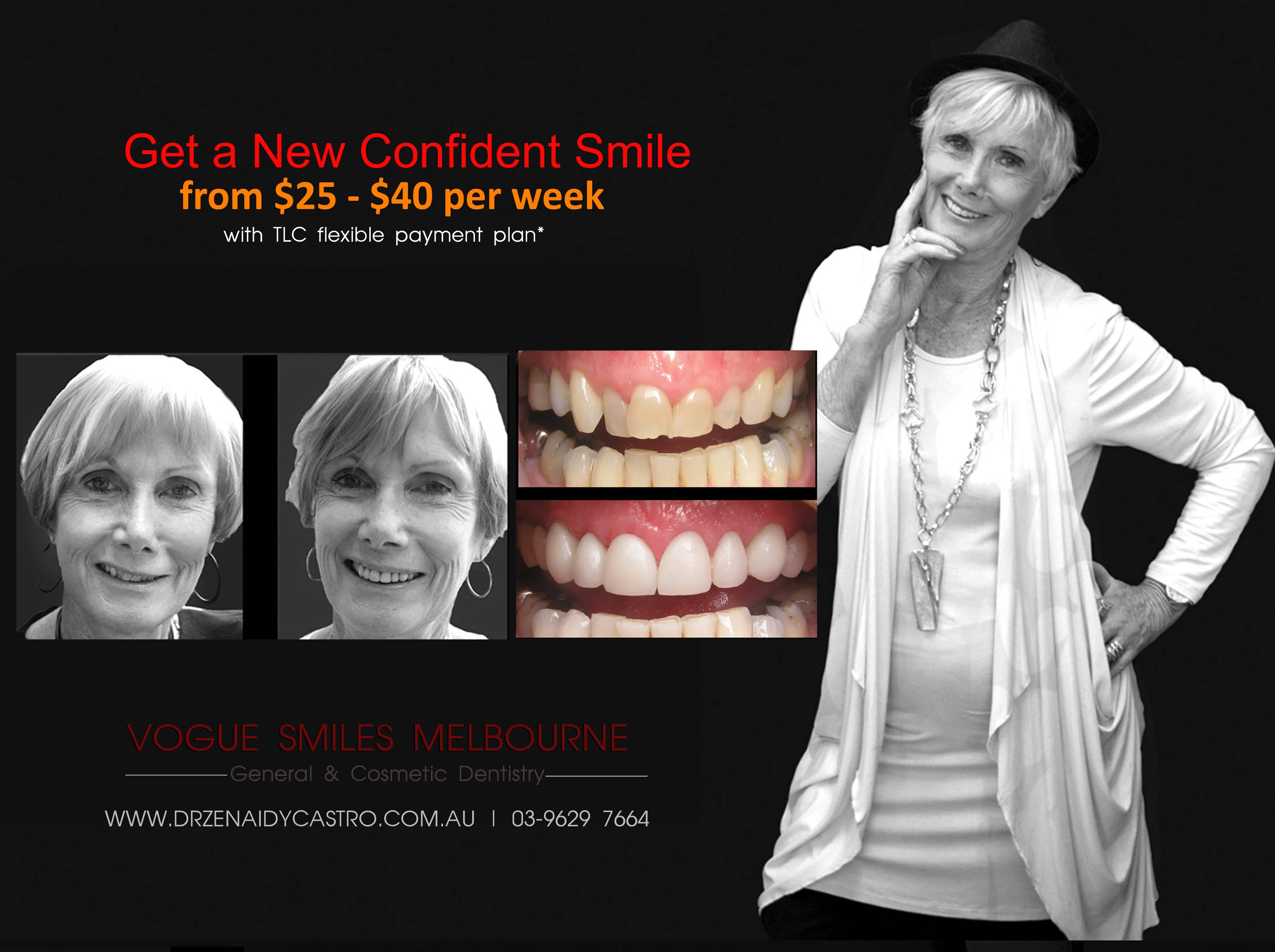 Anti-aging Dental Treatments Melbourne by best cosmetic dentist in Melbourne