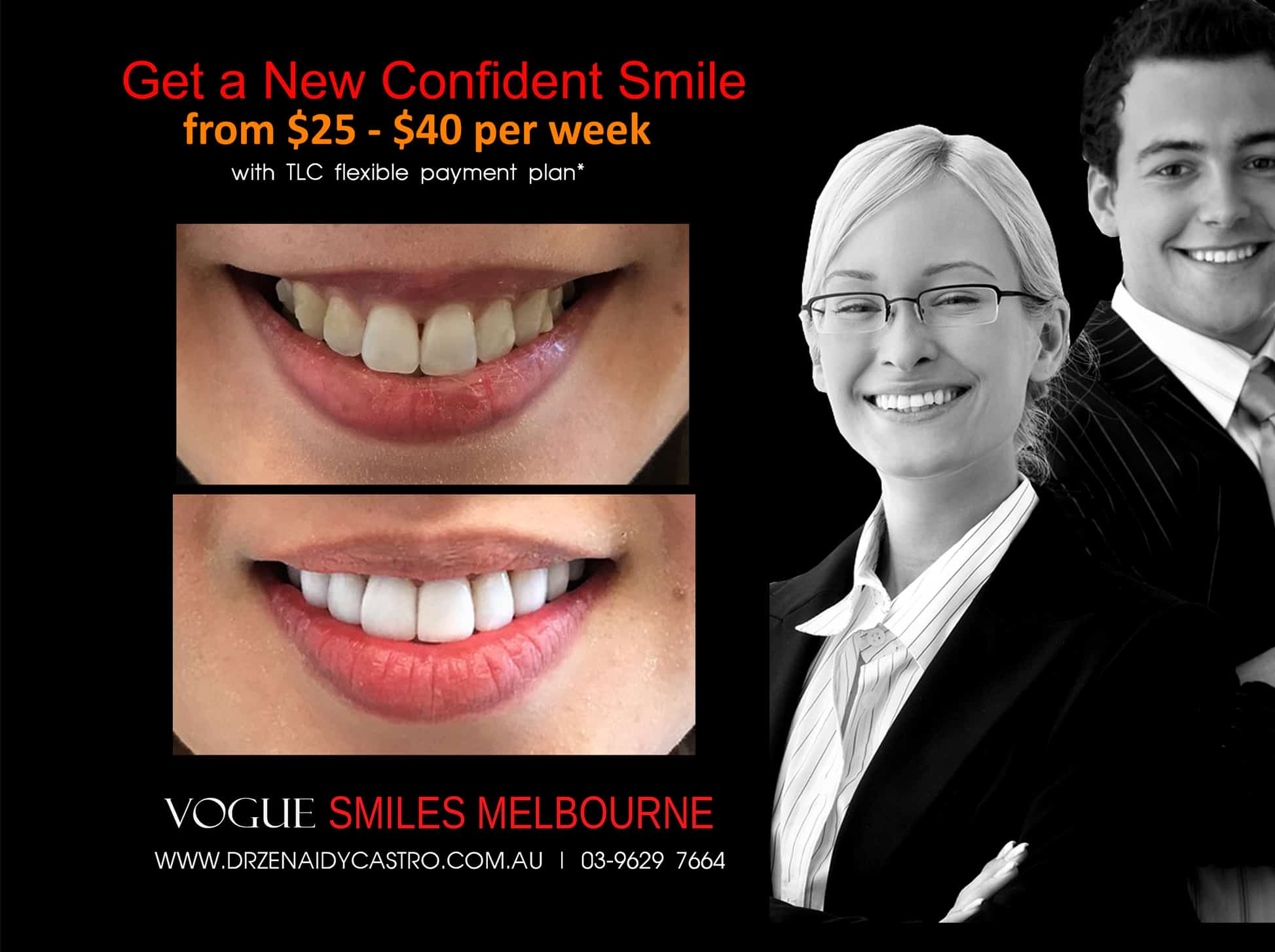 Porcelain Veneer for Whitening Teeth- Permanent Teeth Whitening Treatment Melbourne CBD