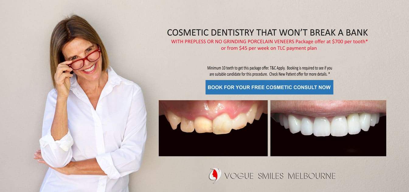 Smile Makeover Facelift Procedures in Melbourne | Non-Surgical Facelift with Porcelain Veneers