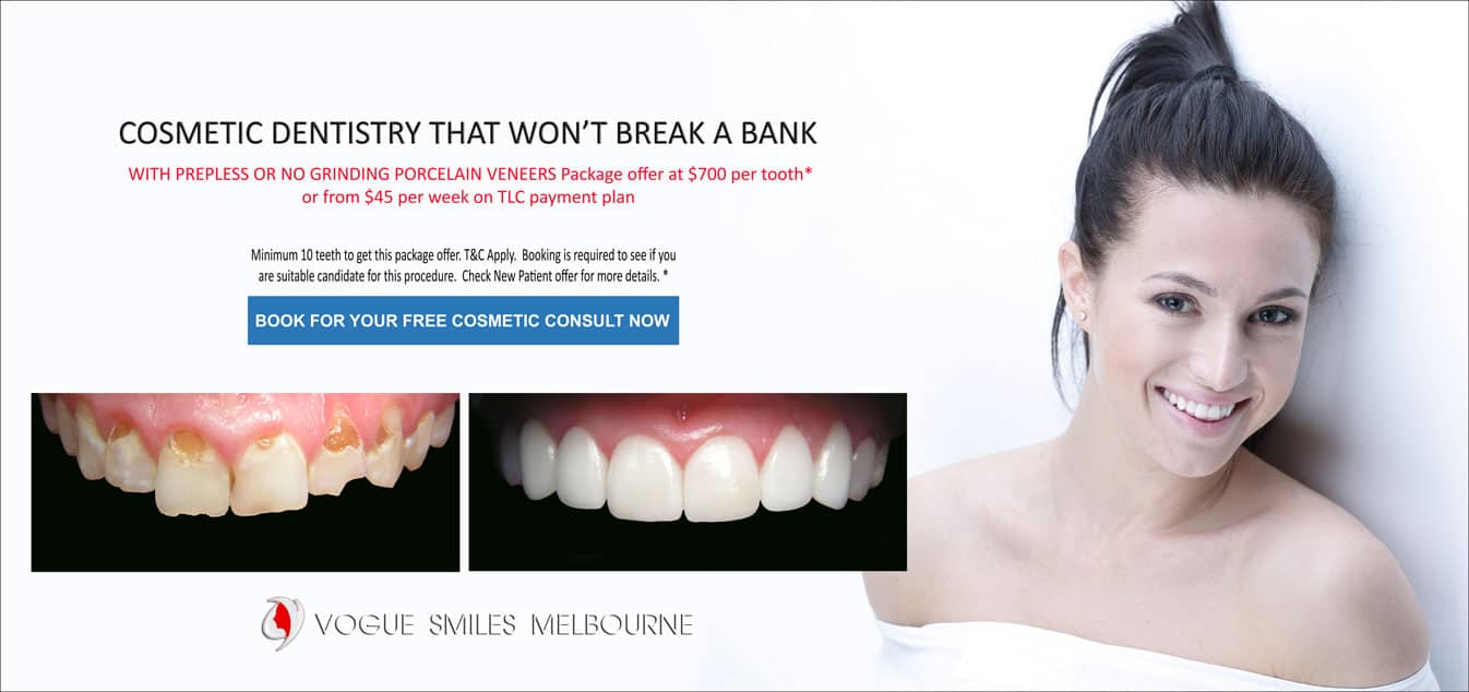 Porcelain Veneer for Whitening Teeth- Permanent Teeth Whitening Treatment Melbourne CBD