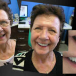 COSMETIC DENTIST IN MELBOURNE VOGUE SMILES MELBOURNE (5)