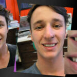 COSMETIC DENTIST IN MELBOURNE VOGUE SMILES MELBOURNE (6)