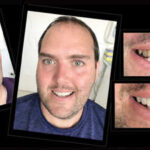 COSMETIC DENTIST IN MELBOURNE VOGUE SMILES MELBOURNE (8)