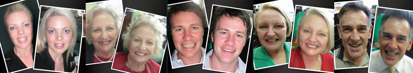 best-Cosmetic-Dentist-in-Melbourne-Before-and-After-v2